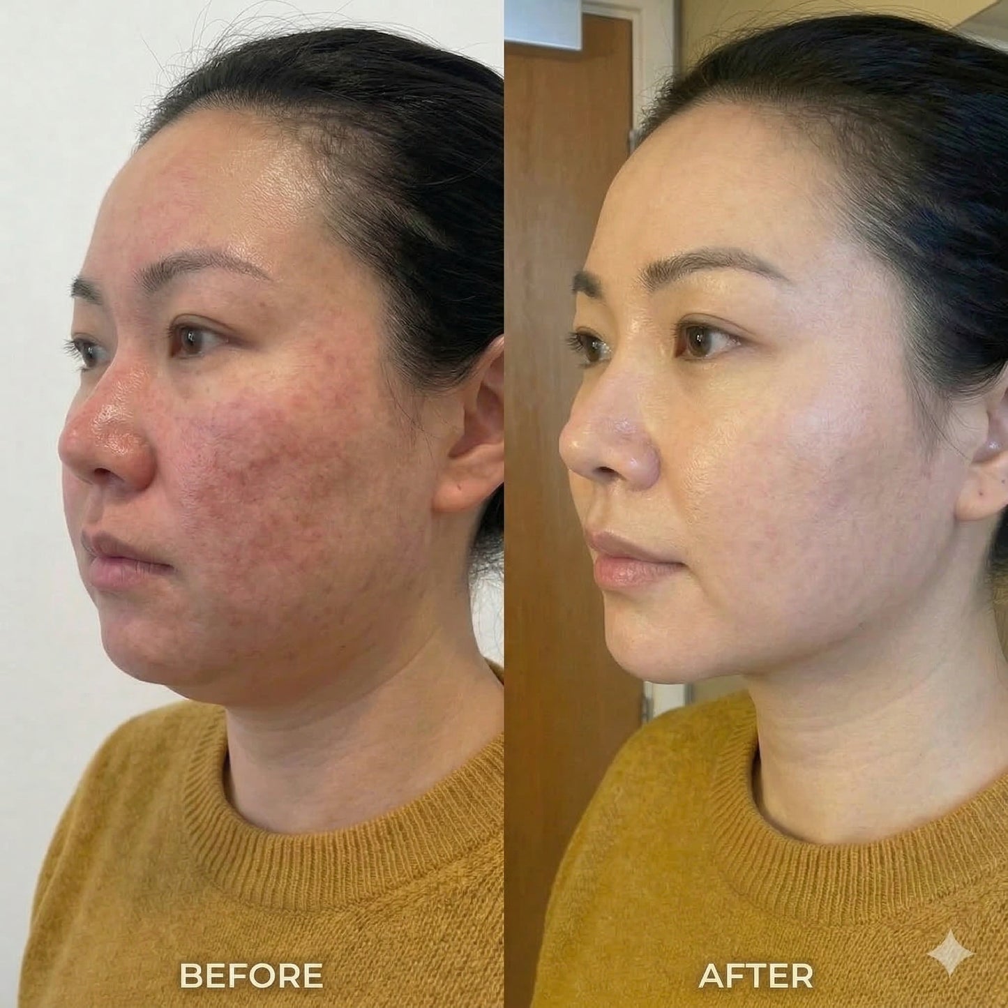 Pure Flow Lymphatic Drainage Drops